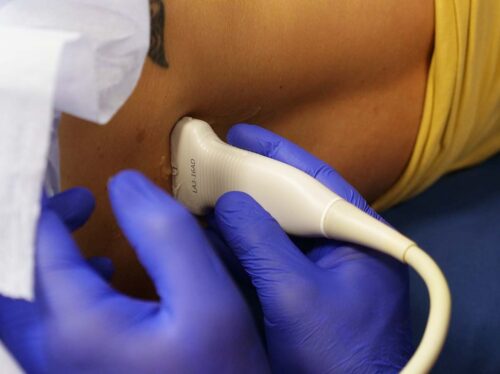 Ultrasound-Assisted Lumbar Puncture Course