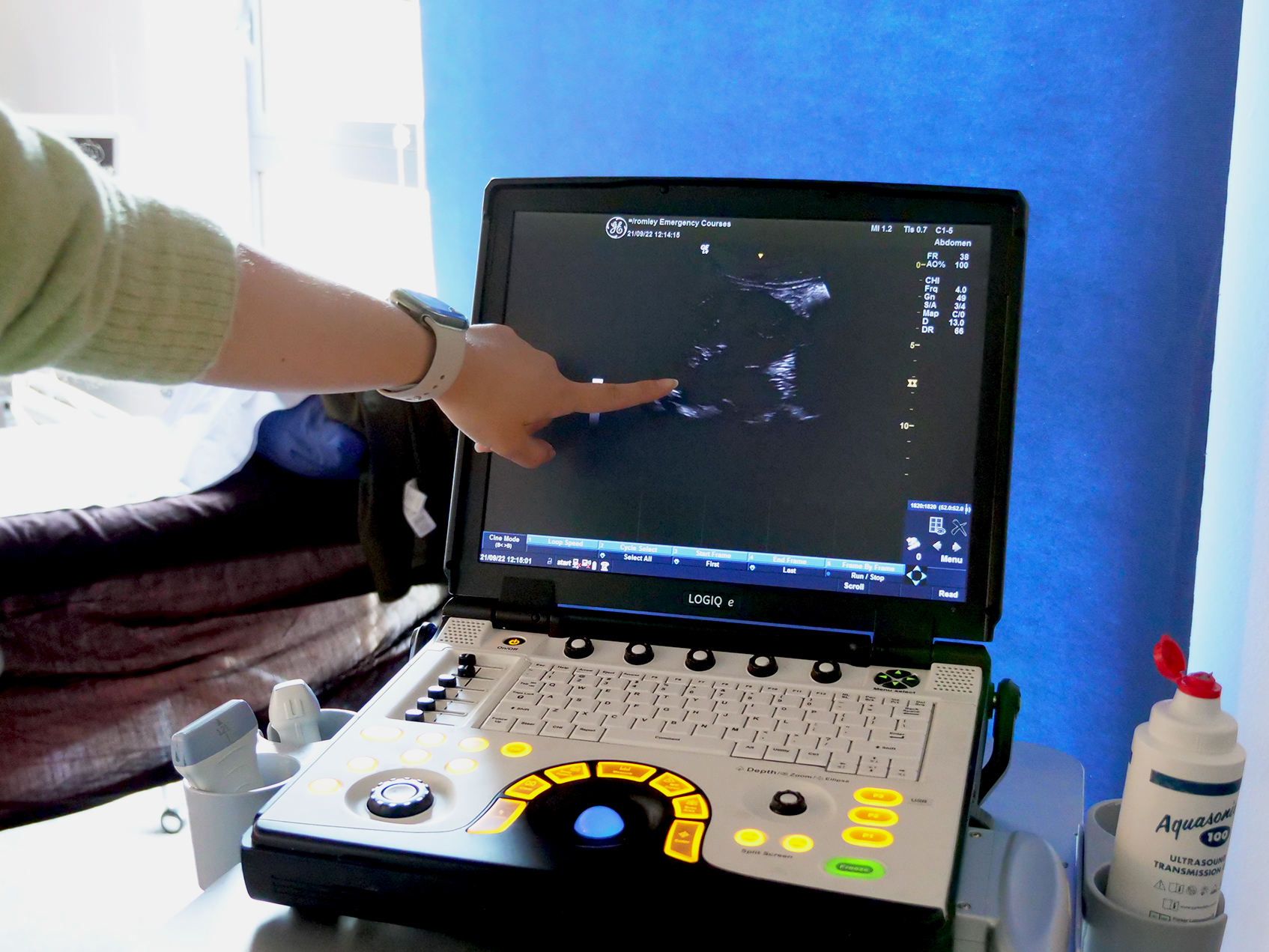 Basic Ultrasound for Surgeons