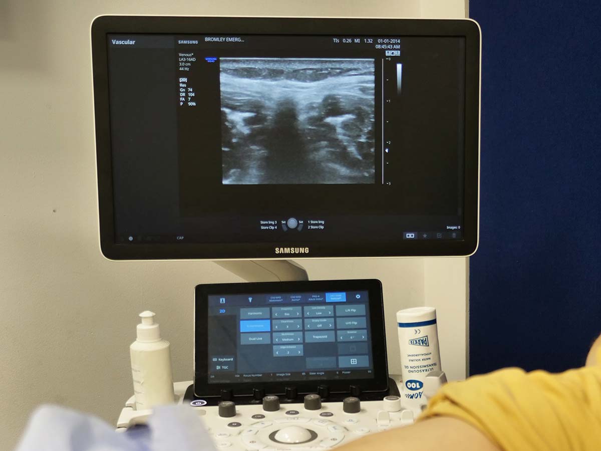 Ultrasound-Assisted Lumbar Puncture