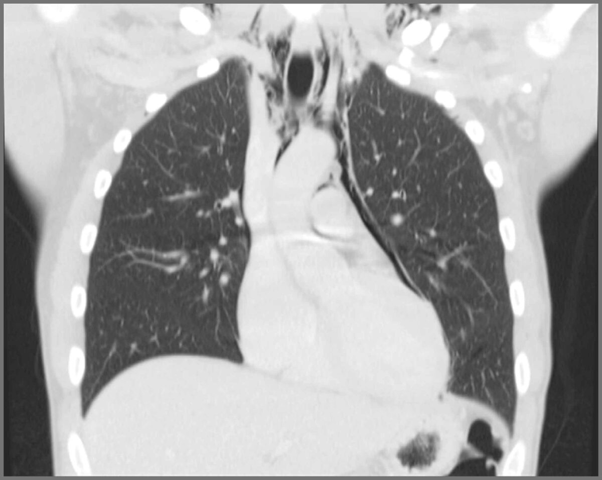 Emergency Radiology course