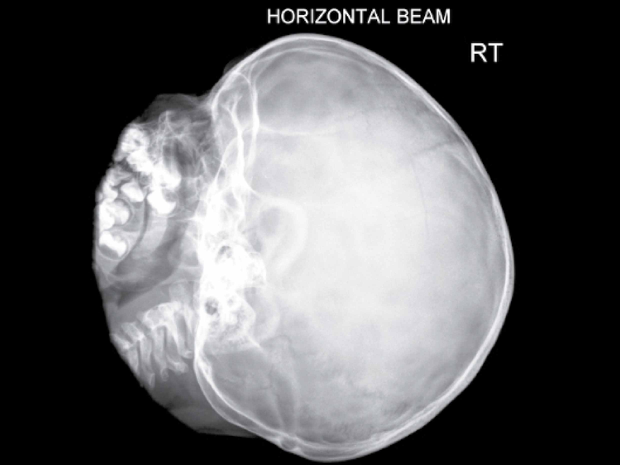 X-ray interpretation course (skull X-ray)