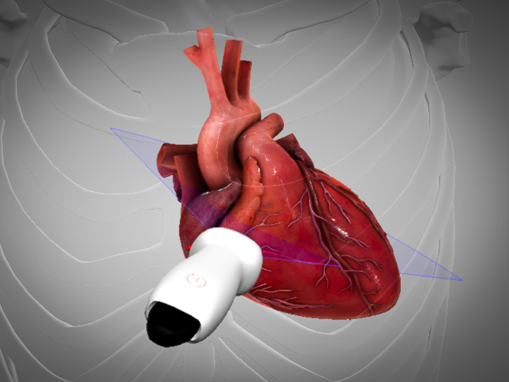 Ultrasound ECHO scanning