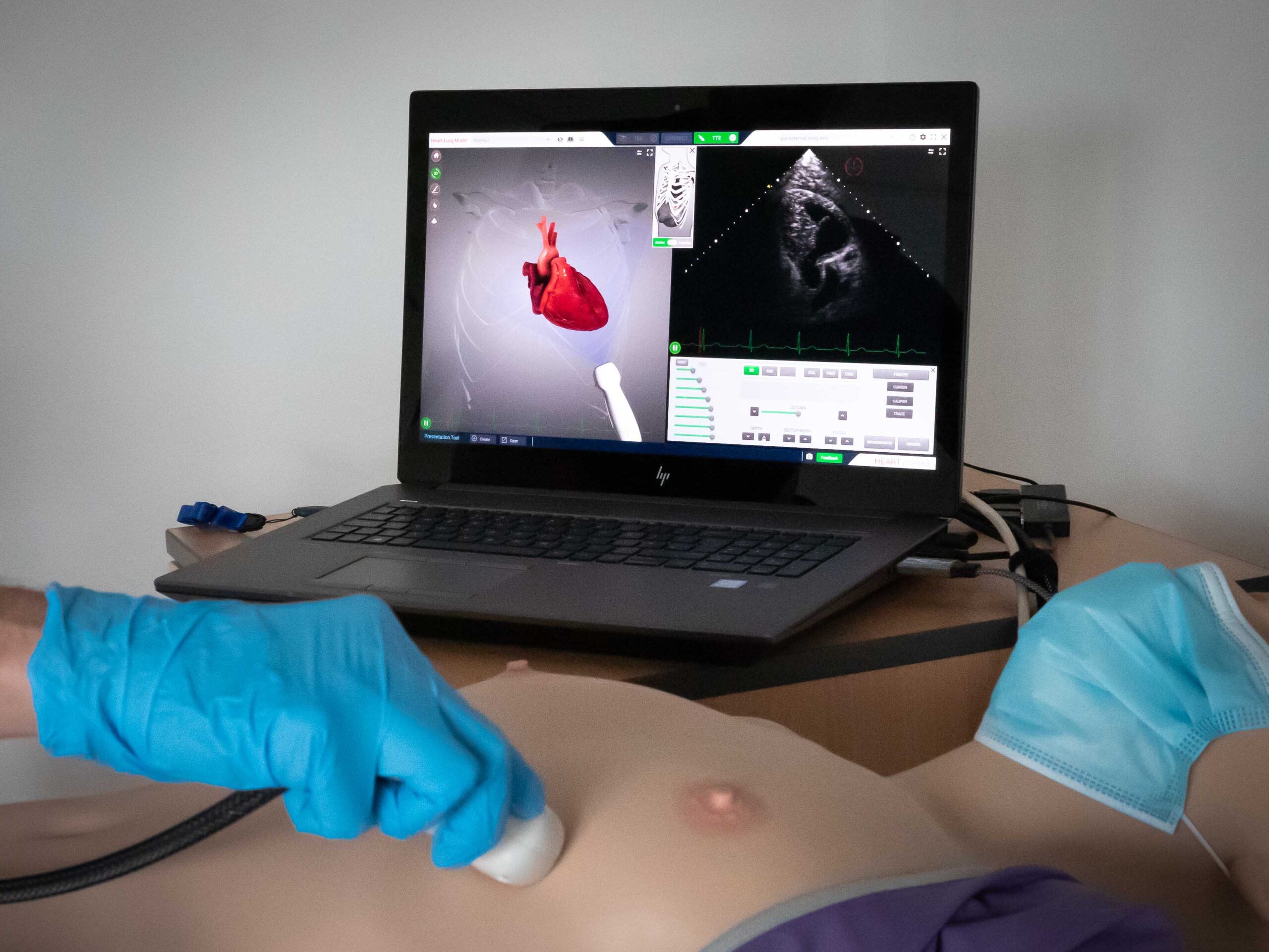 ultrasound-heartworks-scanning FUSIC-Heart-simulator