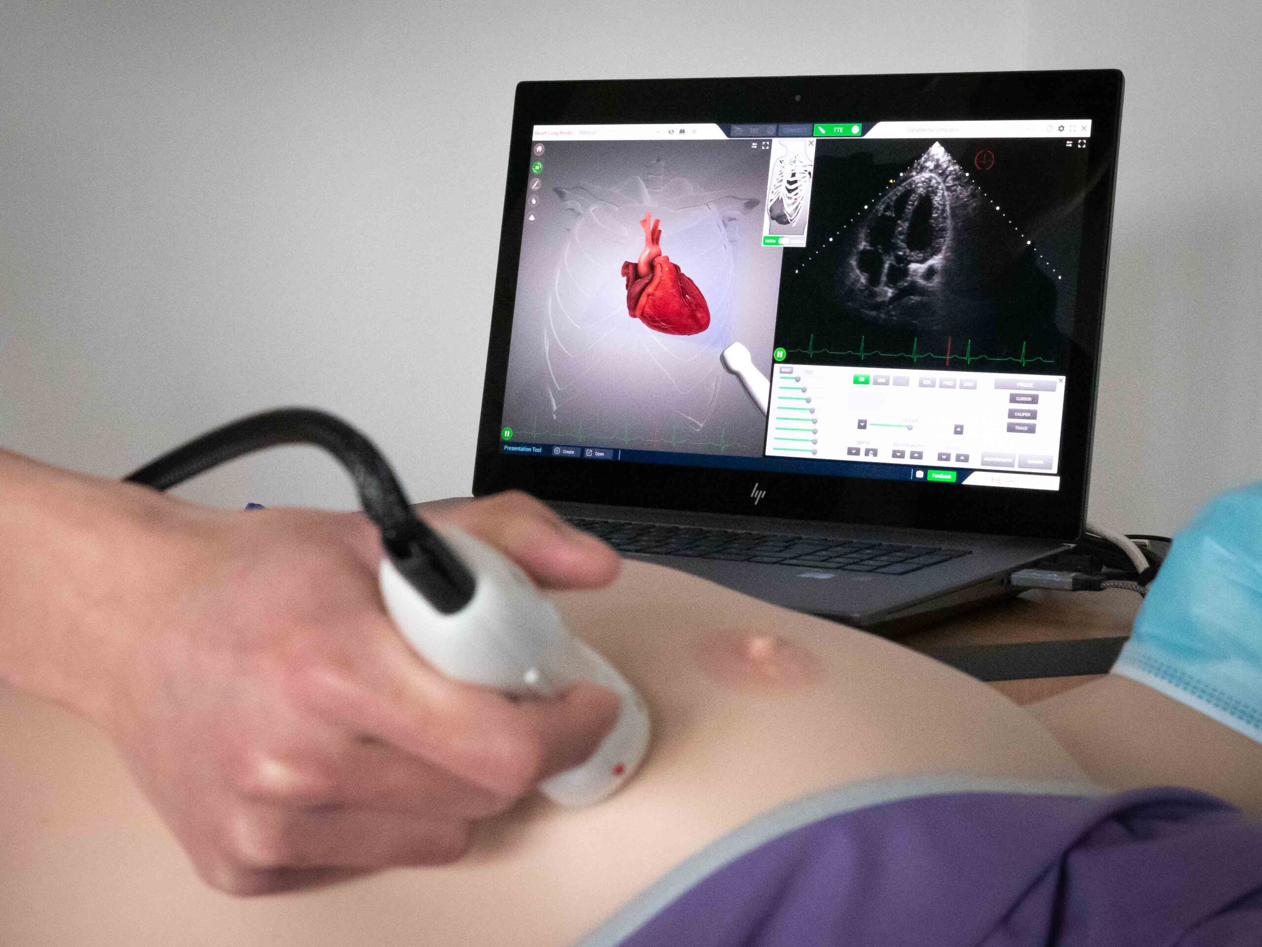 ultrasound-level-2-heartworks-sonogram ultrasound-level-2-scanning