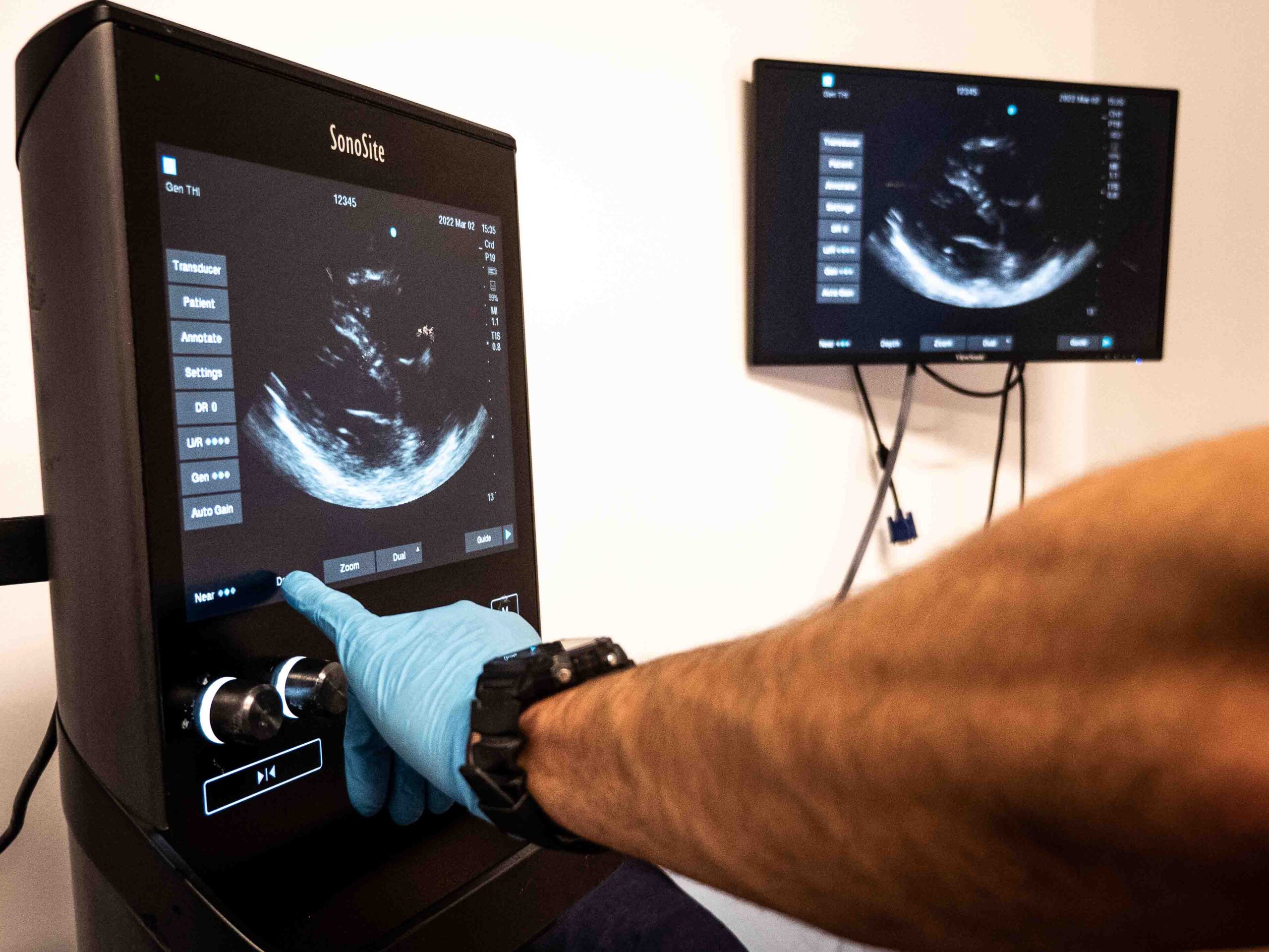 core-ultrasound-machine-operation