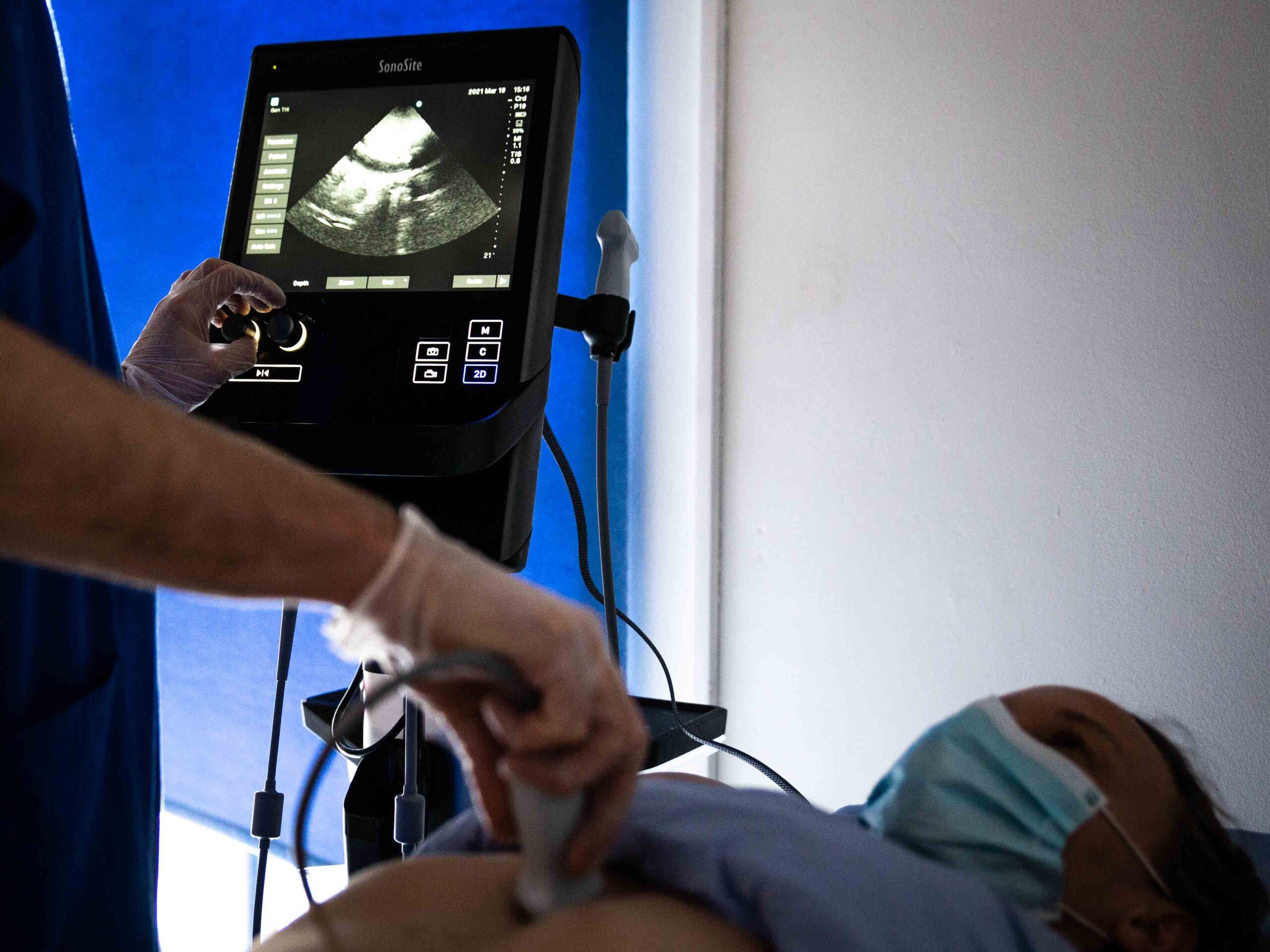 ultrasound-scanning