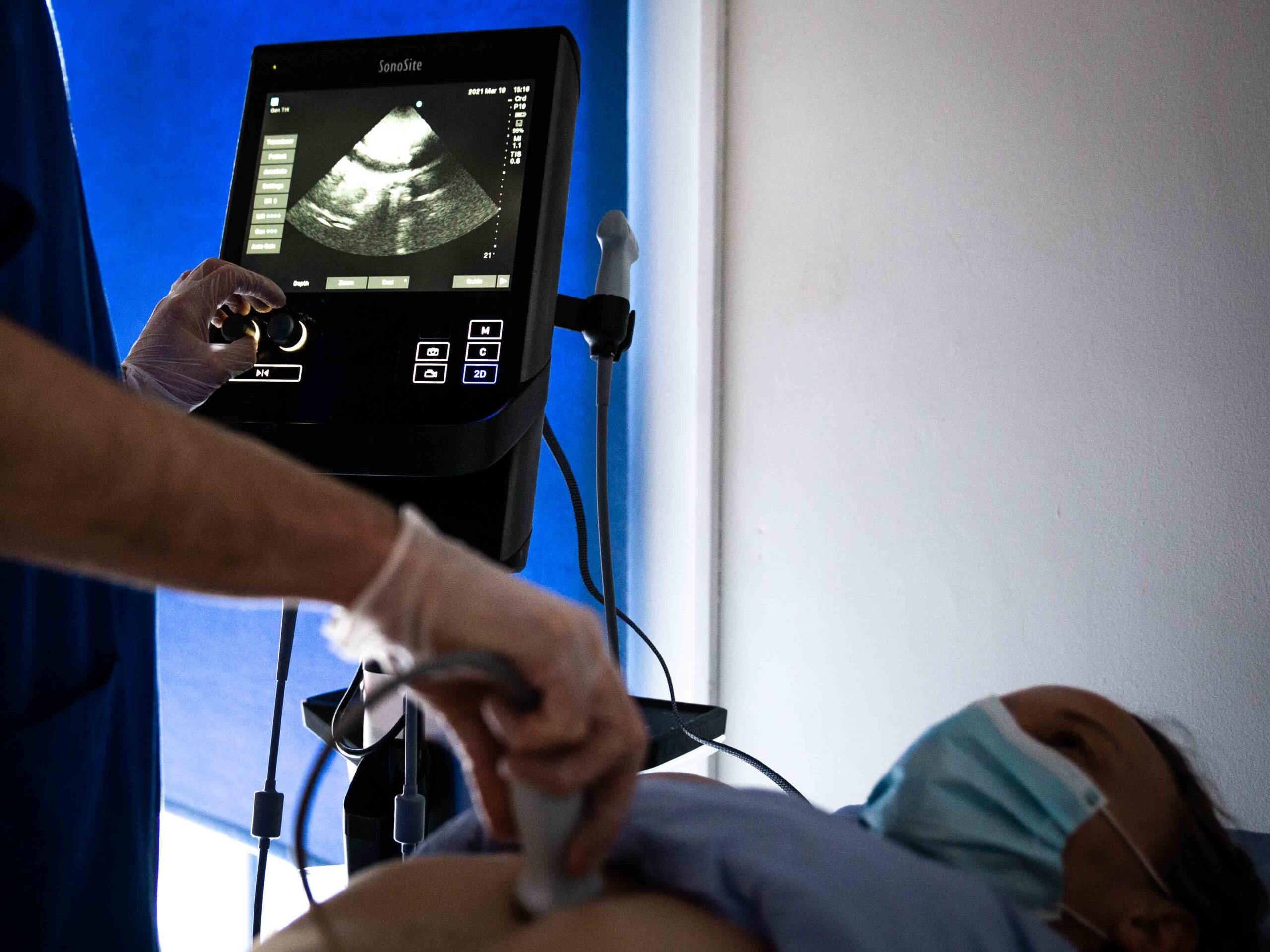 ultrasound-scanning ultrasound-scanning