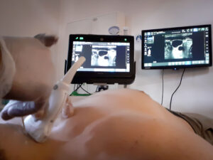 FAMUS-ultrasound